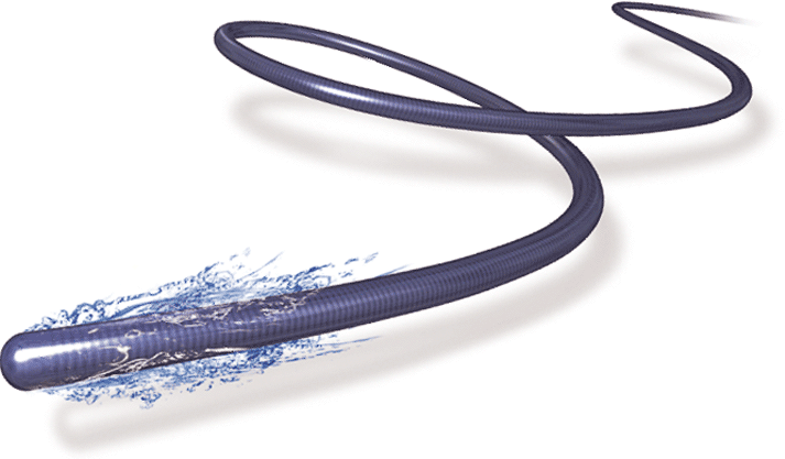 Asahi Receives CTO Indication for Corsair and Coronary Guide Wires ...