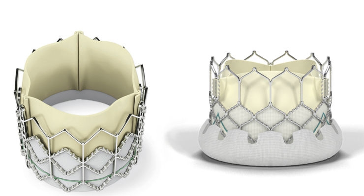 FDA Approves Edwards' SAPIEN 3 Ultra Transcatheter Heart Valve - iData ...