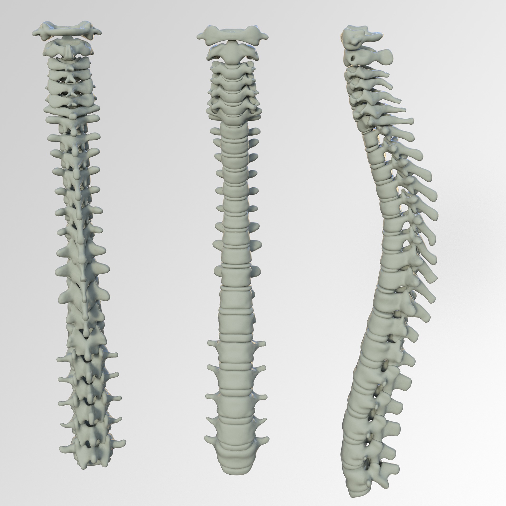 Mexico spinal implants market