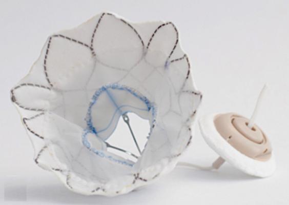 World's First Transcatheter Mitral Valve Approved in Europe