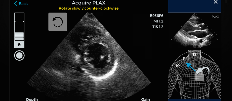 FDA authorizes use of Caption Health’s AI software to capture heart images via ultrasound